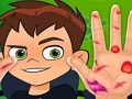 Spel Ben10 Handdokter  online