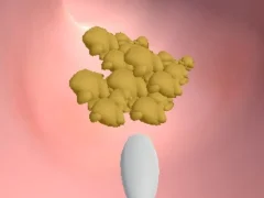 Spel Earwax Clinic online