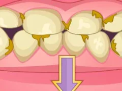 Spel Bad Teeth Makeover online