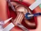 Spel Princess Hips Surgery online