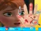 Spel Anna hand doctor online