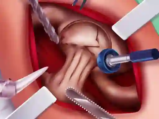 Spel Princess Hips Surgery online
