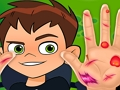 Spel Ben10 Handdokter  online
