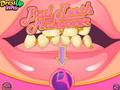 Spel Slechte tanden make-over  online