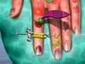 Spel Hand Huid Dokter  online