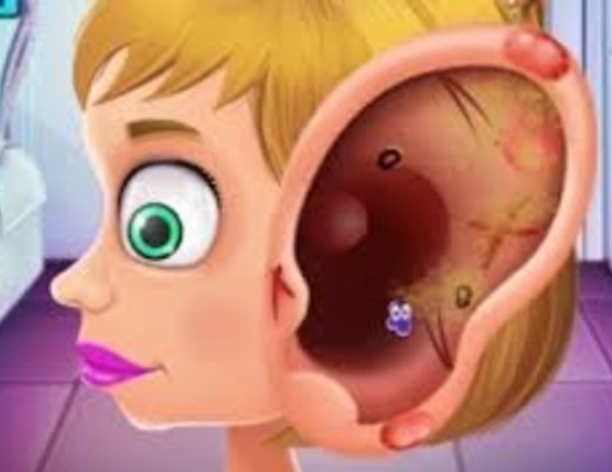 Spel Kinderarts die oren behandelen  online