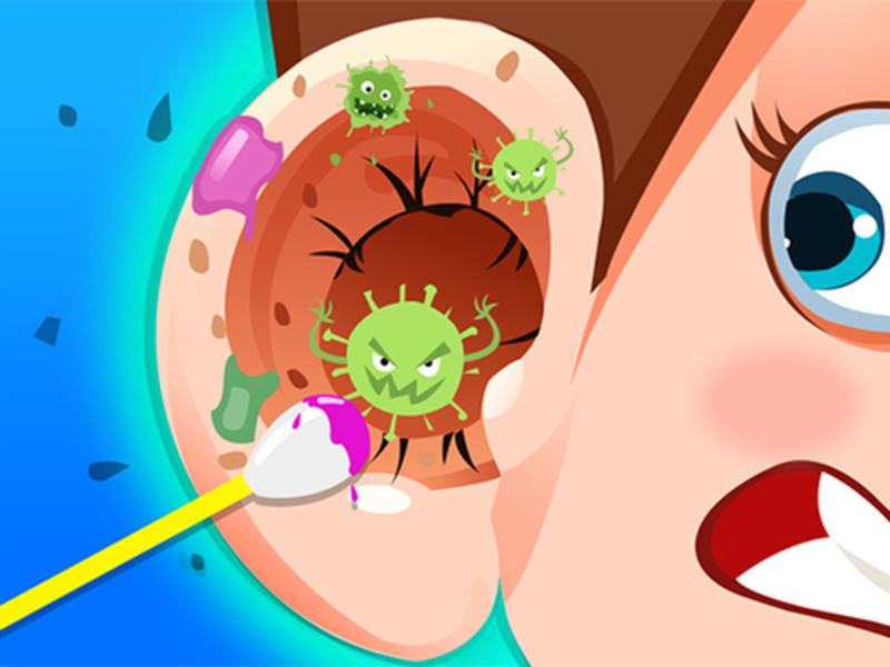 Spel Oorsmeerkliniek online